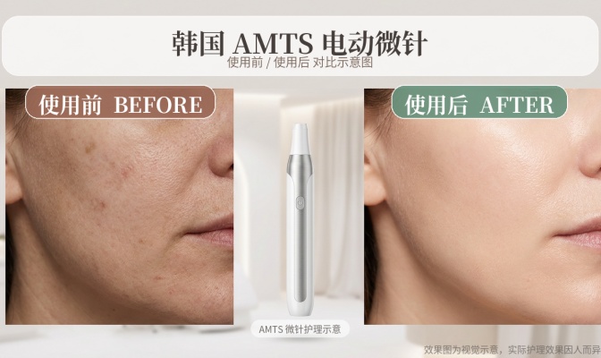 Complete Guide to AMTS Electric Microneedling – Principles, Results, and Prices (2026 Latest)