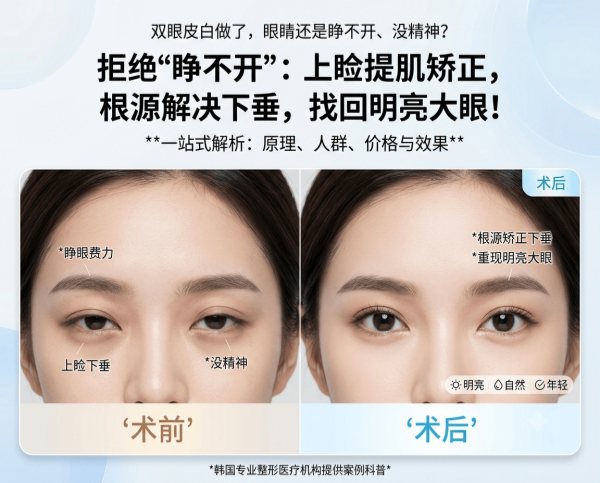 Double eyelid surgery wasted – eyes still look tired and half‑closed? | Complete guide to Korea’s levator resection – addressing ptosis at the source for bright, wide‑awake eyes