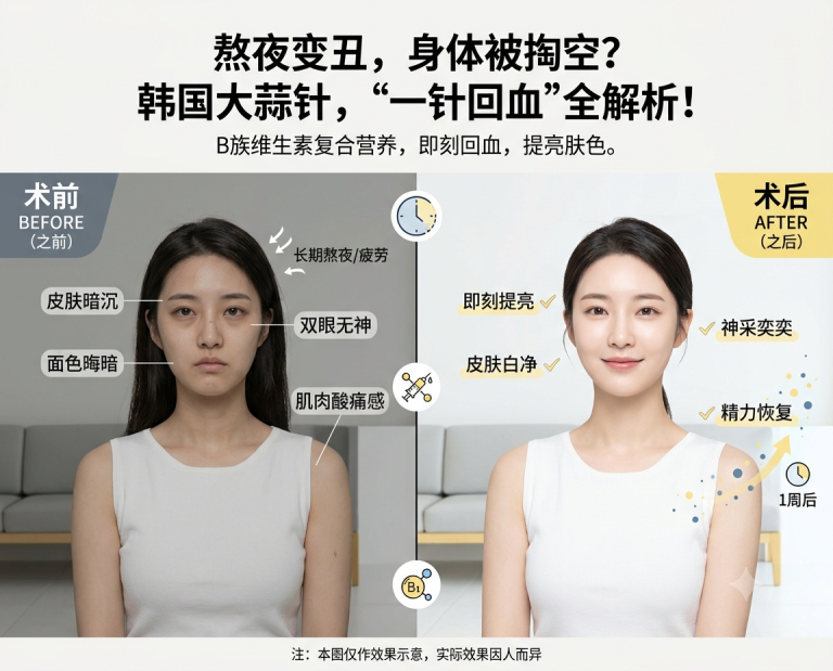 熬夜后“身体被掏空”？｜韩国大蒜针如何快速回血提亮肤色？