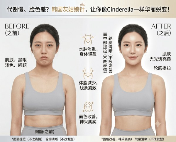 Can’t lose weight with diet and exercise, and your complexion keeps getting worse? | Complete guide to Korea’s Cinderella Injection for accelerating fat burning and antioxidant effects from within