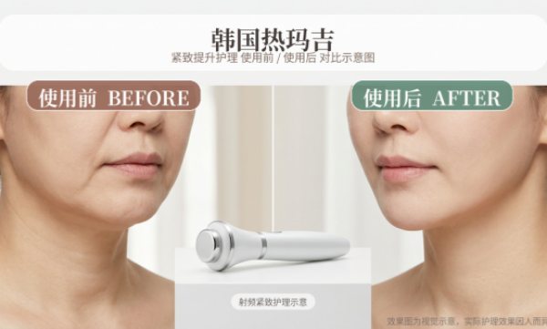 韩国热玛吉完整攻略｜适合人群、效果、价格一次看懂