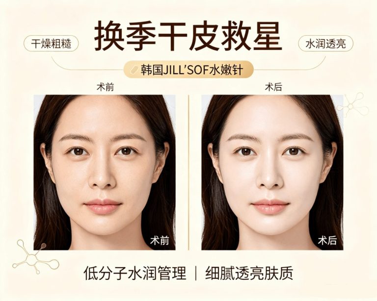 Seasonal Skin Dry as “Sandpaper”? Korean JILL’SOF Hydra Infusion – Intelligent Moisture Delivery for a Plump, Hydrated Glow