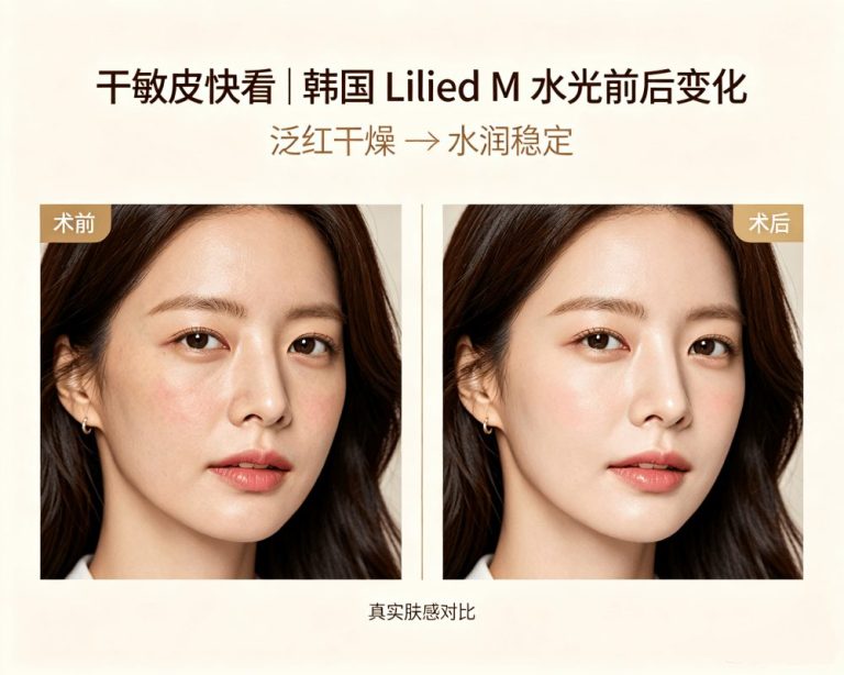 Seasonal Dry/Sensitive Skin Acting Up? Korean Lilied M Skin Booster – Layered Awakening of Skin Self‑Repair