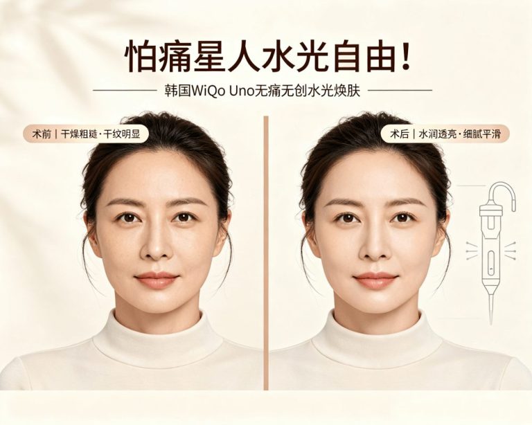 Pain‑Sensitive? Finally, a Comfortable Skin Booster – Korean WiQo Uno Painless Hydration, Smart Infusion for Comfortable Rejuvenation